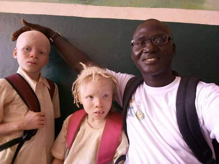 Projecto sobre albinismo 